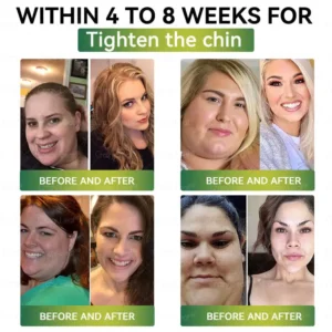 CrazyLeaf® GLP-1 Weight Loss Oral Solution Obesity,Cardiovascular Diseas, Diabetes, Sleep Apnea, Joint Problems and More