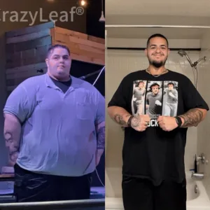 CrazyLeaf® GLP-1 Weight Loss Oral Solution Obesity,Cardiovascular Diseas, Diabetes, Sleep Apnea, Joint Problems and More