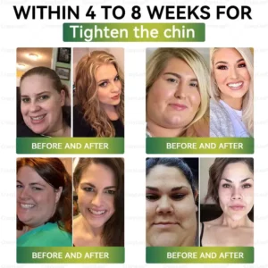 ✨CrazyLeaf® Meglutide GLP-1 Activating Oral Solution with Collagen & Matrixyl 3000|✨Obesity,Cardiovascular Diseas, Diabetes, Sleep Apnea, Joint Problems and More