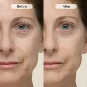 Biancat® TightShift Precision Contour & Firming Serum