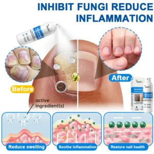 Divifit® Magnesium Herbal Psoriasis Spray